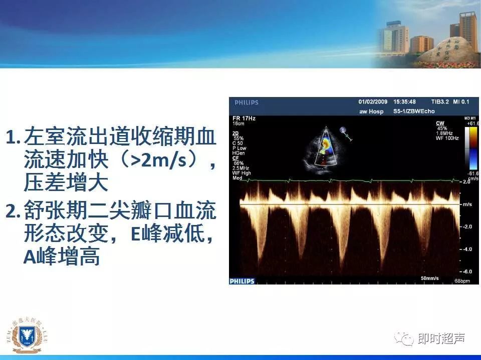 左室肥厚的超声心动图诊断思路_腾讯新闻