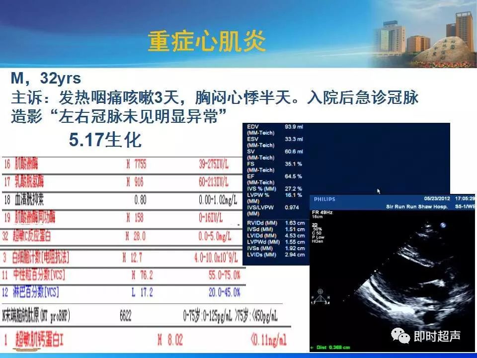 左室肥厚的超声心动图诊断思路_腾讯新闻