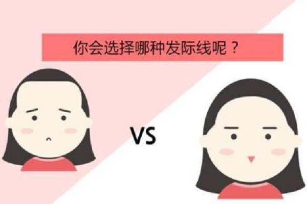 拒绝风吹起的尴尬论发际线对拯救颜值的重要性