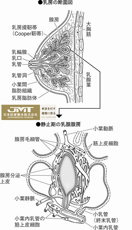 乳腺癌是在乳腺組織中形成的,大多數發生於乳腺管,但是,也有一部分是