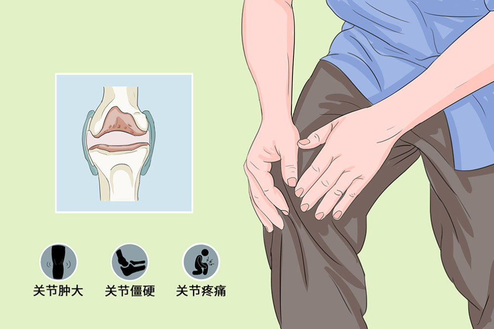 关节肿大僵硬疼痛退行性骨关节病需要提防