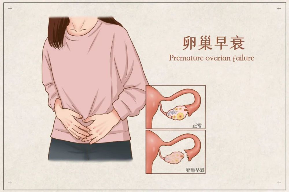 每天熬夜熬成大熊猫当心卵巢早衰这些预防措施要知道