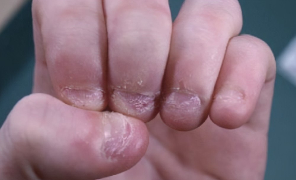 单从生理上来说,啃咬指甲获得的"爽感"应该比不上"抠鼻孔""掏耳朵"