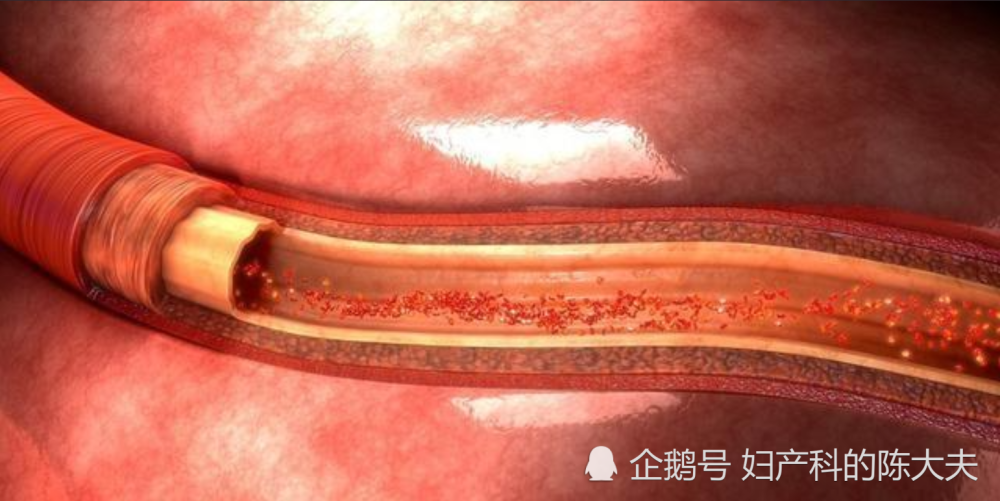 猎奇科普:为什么电视剧里割腕自杀就会死,断了手臂却还活着?