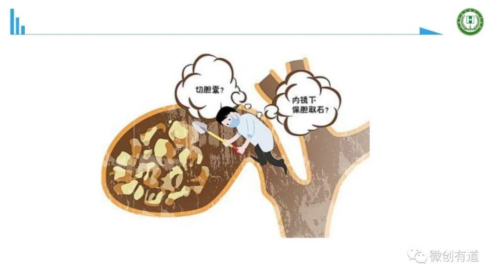 胆石症的预防和治疗