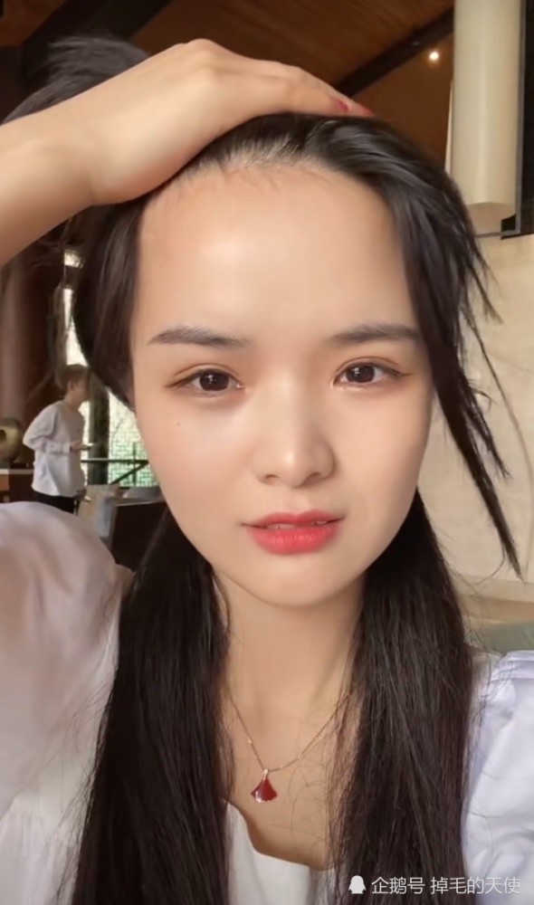 七阿姨额头照曝光发际线很高脸变得漫无边际网友和贝勒爷有一拼