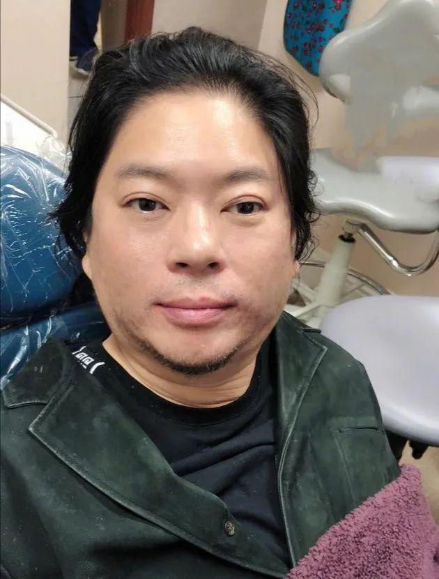 高晓松妹妹颜值不输嫂子夕又米嫁德国人生混血比哥哥活得潇洒