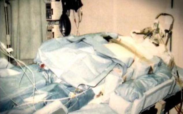 有人说,医生之所以强行给大内久续命,是想观察人体