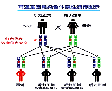 耳聋基因在我以往的客户案例中,其中一个客户的父亲和姑姑都有听力