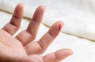 医生|3岁娃一哭脸就“出血”，手指小伤差点丢命……医生：这病不容忽视