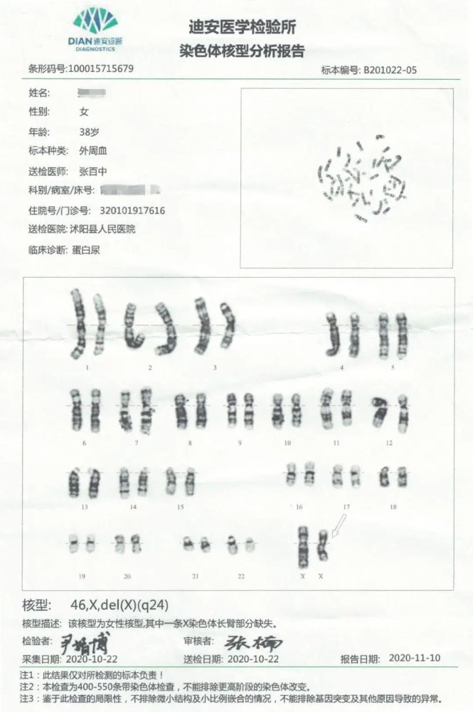 病例分享身高168cm竟然是turner考验知识储备的时候到了