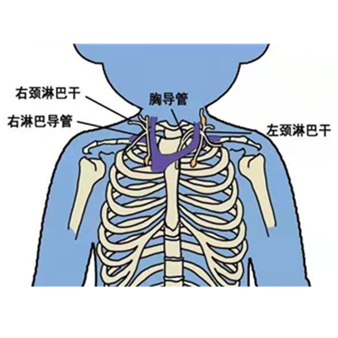 乳糜胸|出生自带“干粮”？小宝宝的胸腔里居然藏着“牛奶”！