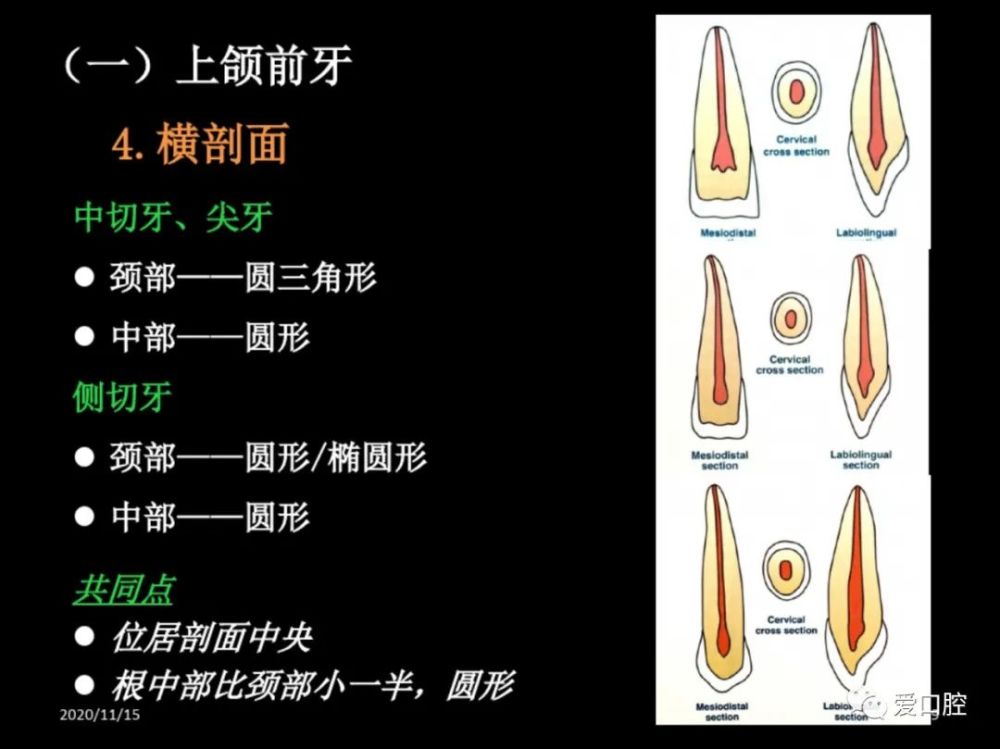 恆牙髓腔形態解剖特點