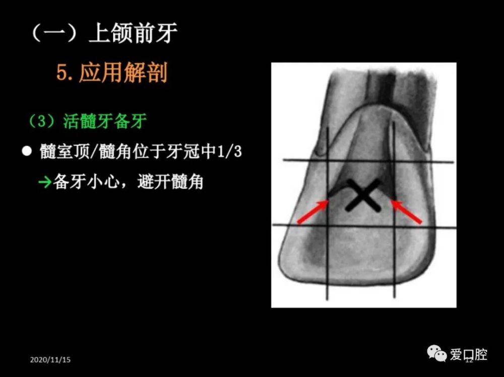 恆牙髓腔形態解剖特點