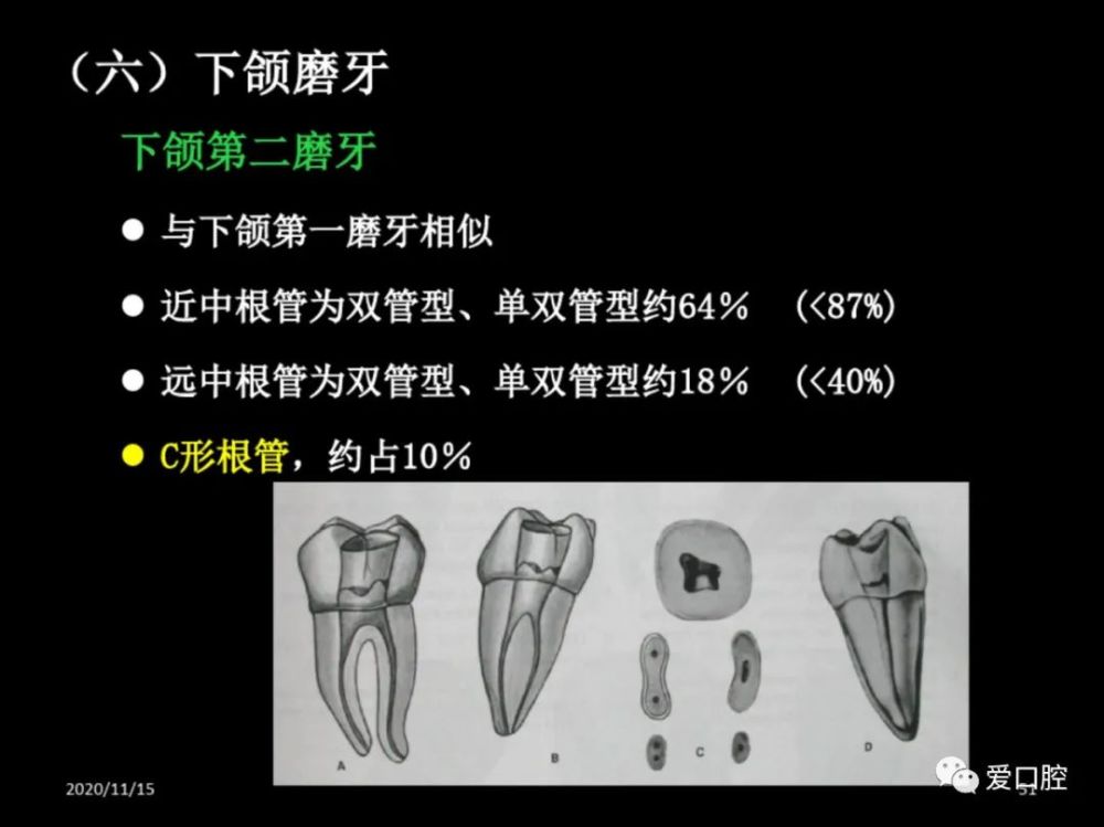 恆牙髓腔形態解剖特點