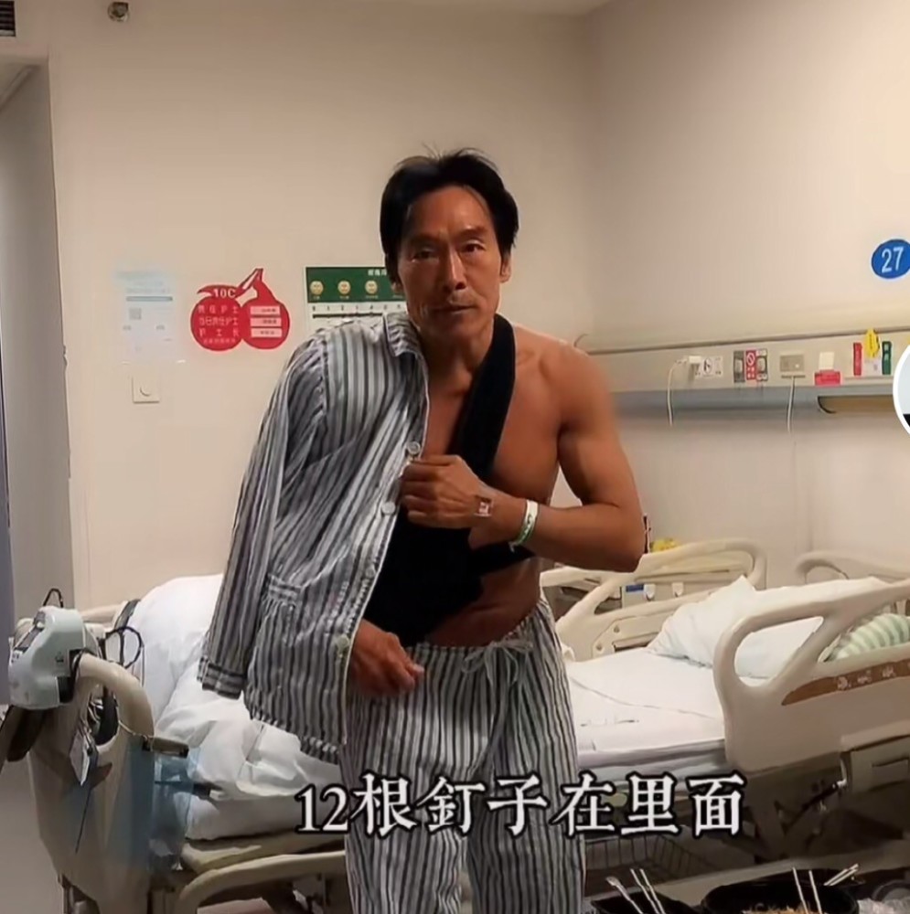 56岁郑浩南再拍古惑仔戴一副红墨镜气势足做完手术刚出院