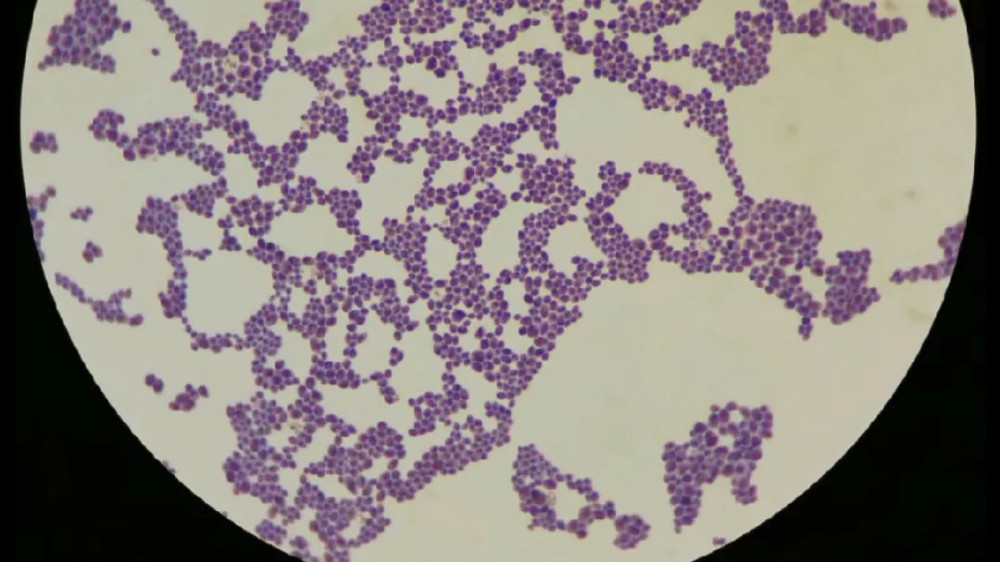 耳念珠菌|陈根：自然环境首次发现超级真菌，跨越十年溯源路