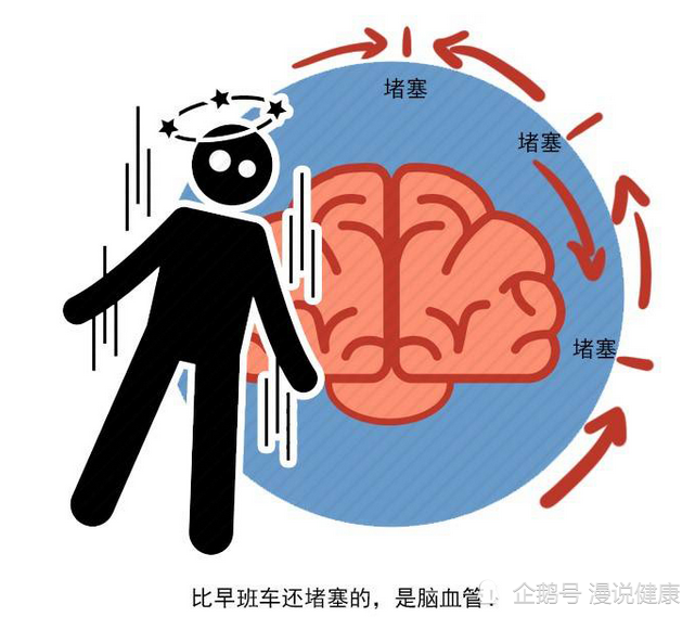脑梗|从脑梗到死亡，身体会发出3次求救信号，抓住一个，或许能保命！