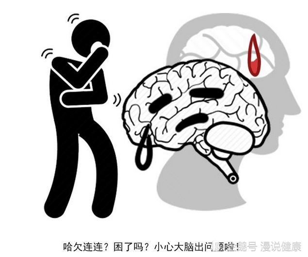 脑梗|从脑梗到死亡，身体会发出3次求救信号，抓住一个，或许能保命！