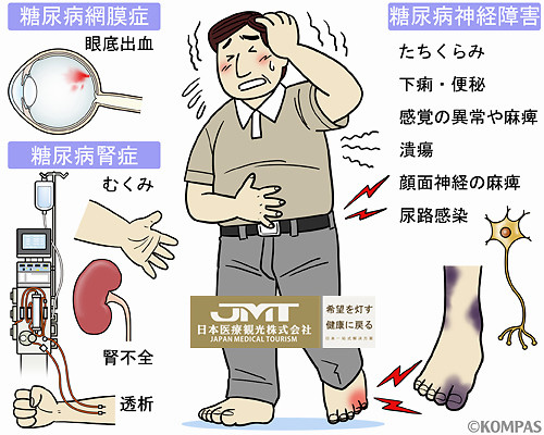 糖尿病并发症|JMT日本常见病治疗-糖尿病并发症的原因和危险的三大并发症