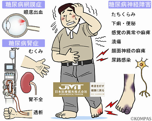 jmt日本常见病治疗糖尿病并发症的原因和危险的三大并发症