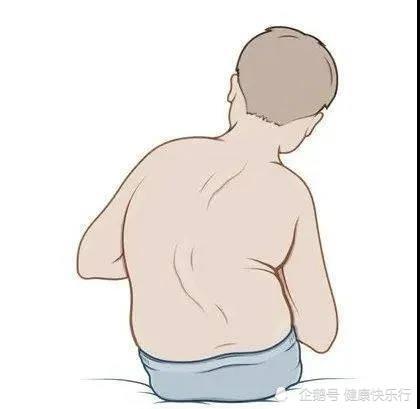 郑州京科脊柱侧弯矫正中心科普 脊柱侧弯核心知识 腾讯新闻