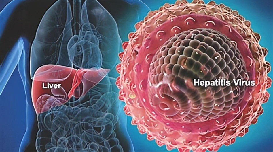 慢性乙肝|慢性乙肝，为什么要等到转氨酶高，才抗病毒治疗？医生告诉你原因