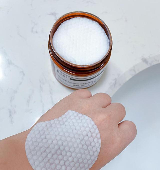 工作压力大老长痘痘水杨酸棉片真能消痘吗女生来测评