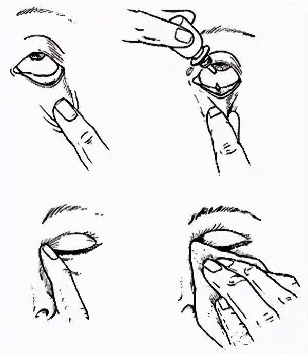滴眼藥很簡單麼這些知識請收好