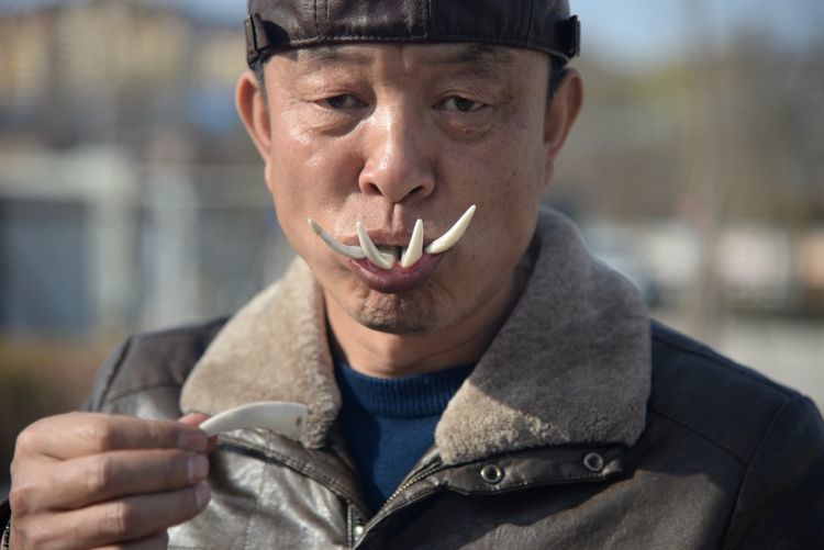 男子为追求野性美口含8颗猪牙嘴巴溃烂3年靠盐水漱口支撑