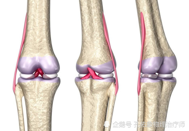 在之前的科普文中,有說過是大腿骨和小腿骨上的脛股關節面的軟骨退變