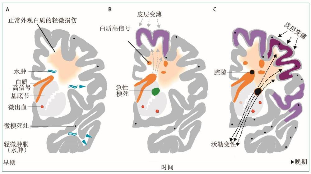 吩噻嗪類抗精神病藥物中毒主要的病因是什麼臨床表現有哪些