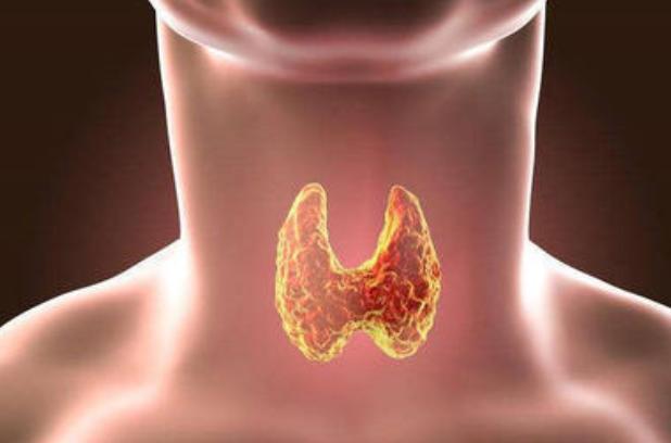3種常見發物或會加速甲狀腺結節生長請主動遠離