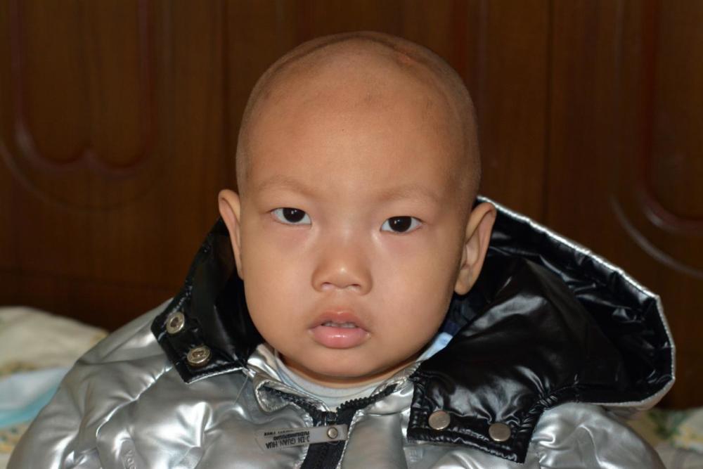 我1岁毁容成了面目全非的怪人结婚生子又遭命运捉弄