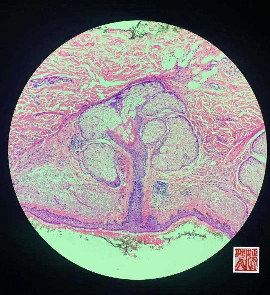 手绘病理世界故乡的春