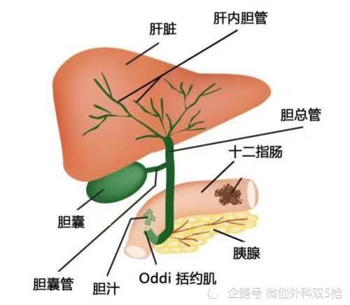 下面我们具体介绍一下胆囊结石相关的知识点