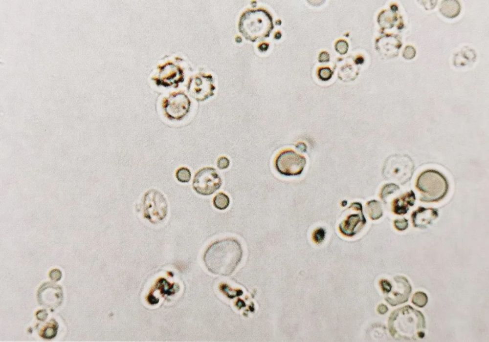 一文读懂尿液红细胞形态分析