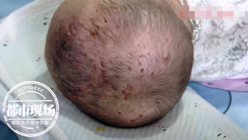 迎战12种儿童杀手国家卫健委再出手