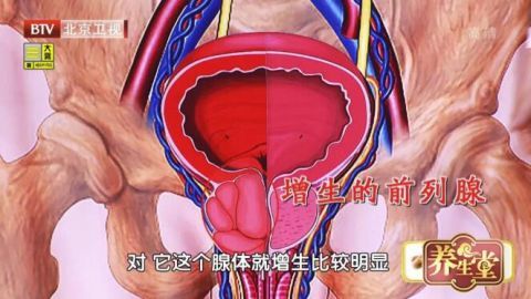 女性膀胱前面图片