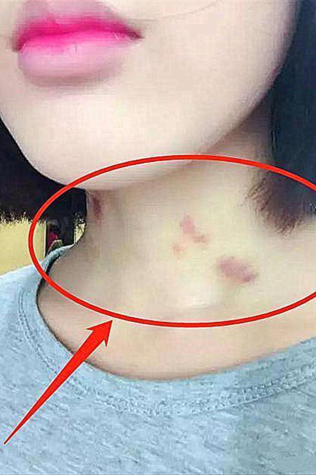 12岁女儿脖子出现草莓吻痕爸爸不停逼问孩子的话让人反思