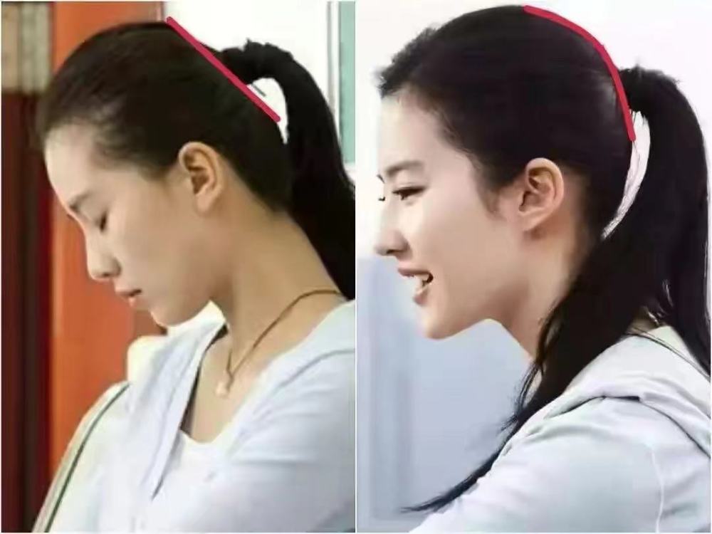 宝宝到底需不需要睡头型?