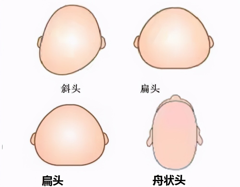 宝宝到底需不需要睡头型?看完刘亦菲和刘诗诗对张图,你就明白了