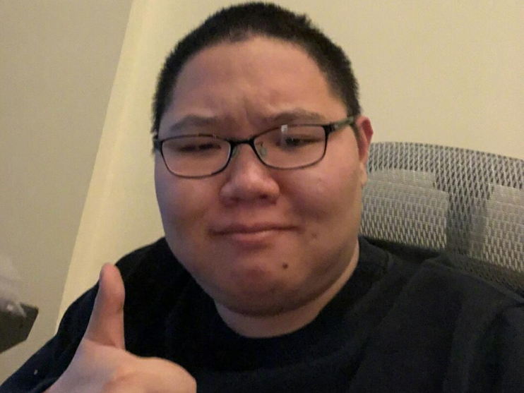 PDD展示肿瘤照片,辟谣装病言论,公开处刑