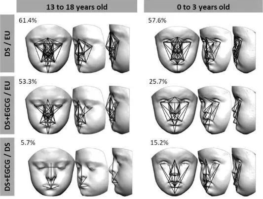 新发现绿茶提取物或能调节唐氏综合征患儿的面部发育