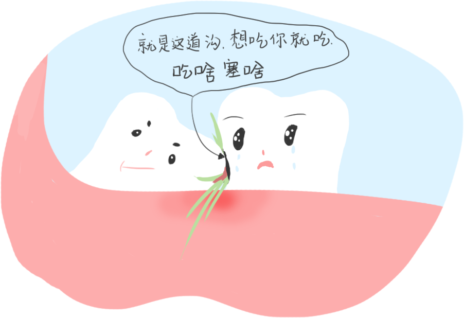 智齿:对于年轻人来说,长得不好的智齿也是容易发生塞牙的一大原因