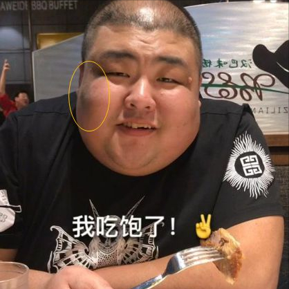 泡泡龙离世这些网红吃播依旧暴饮暴食身体状况令人担忧