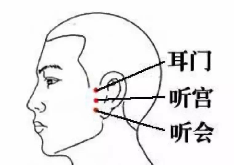 针灸常用腧穴——听会_腾讯新闻
