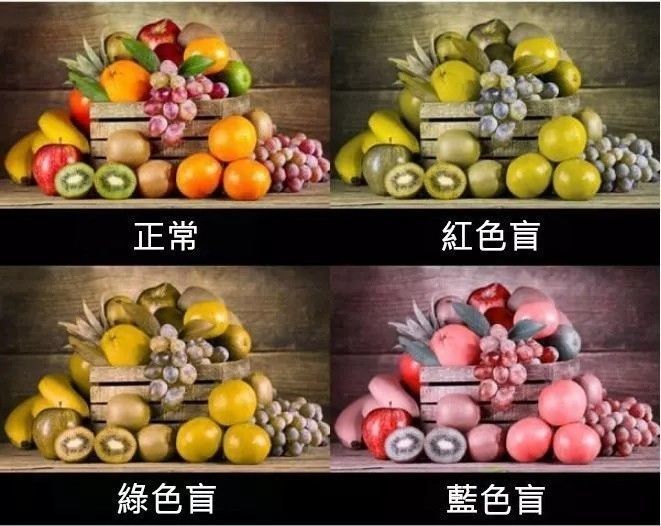 科普u201d一分钟极致享受，十一种眼病的成像！_腾讯新闻