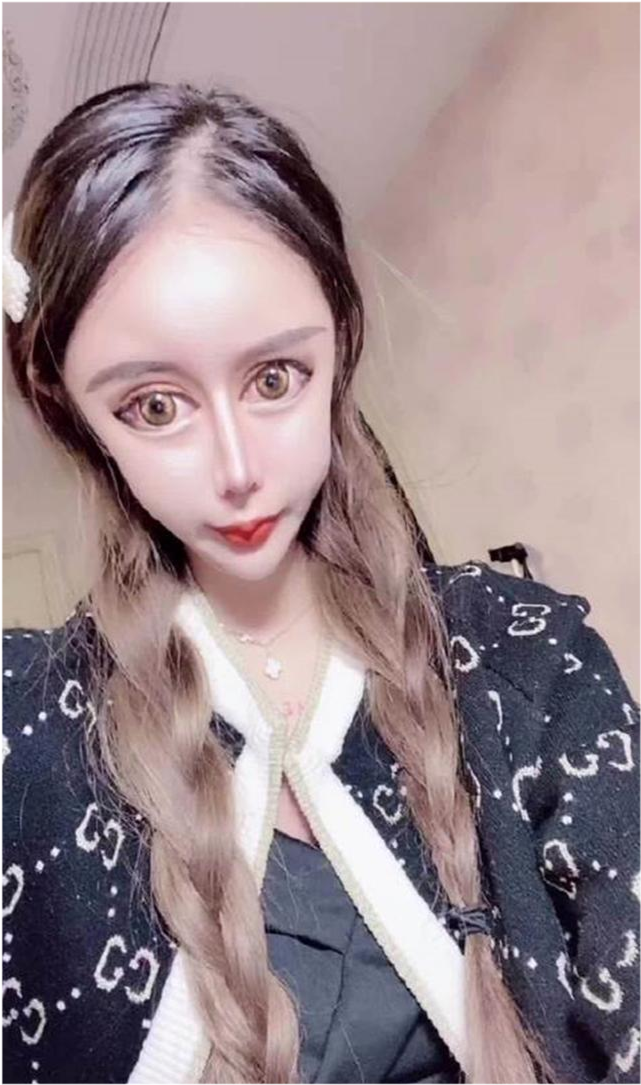网红女孩娜娜3年整容60次花费上百万结局让人很意外