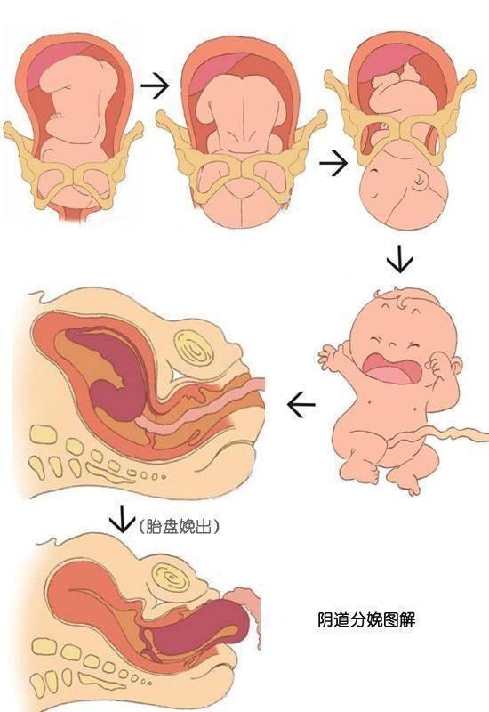 分娩产程揭秘,教你如何减轻生娃疼痛,准妈妈你们准备好了吗